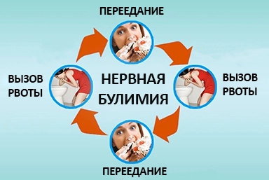 Лечение булимии в Выксе